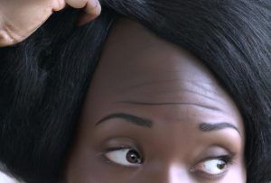 Alopecie_traction
